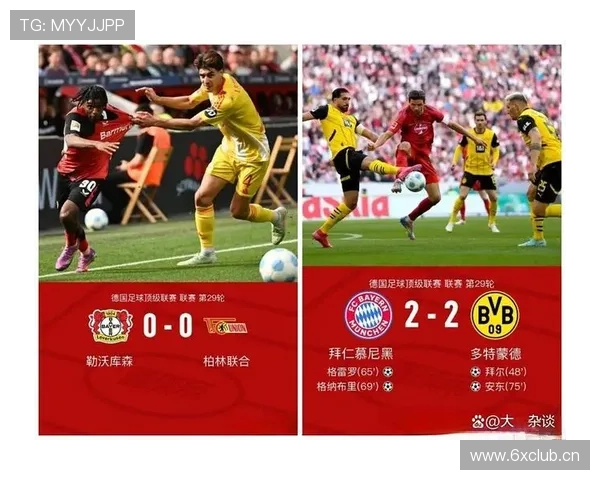 凯恩高效表现掩盖隐患,拜仁慕尼黑进攻结构是否失衡?